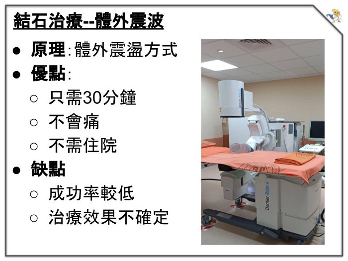 體外震波碎石