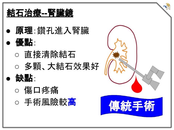 腎臟鏡