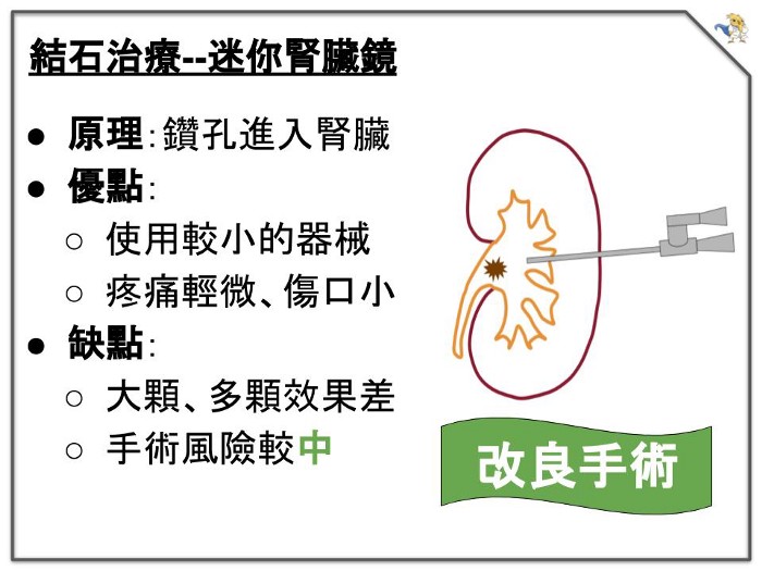 迷你腎臟鏡