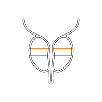 UroLift微創攝護腺拉開手術 icon
