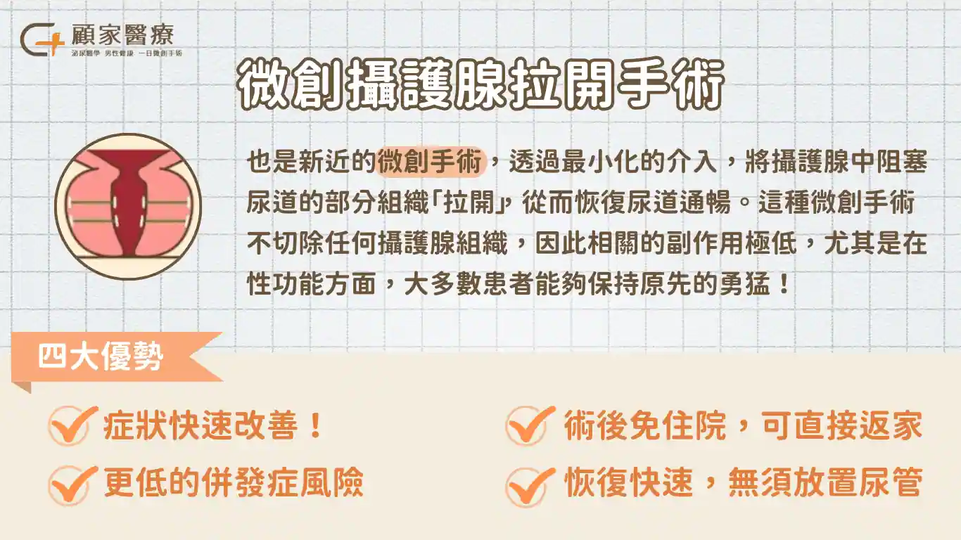 攝護腺肥大手術介紹－攝護腺拉開術