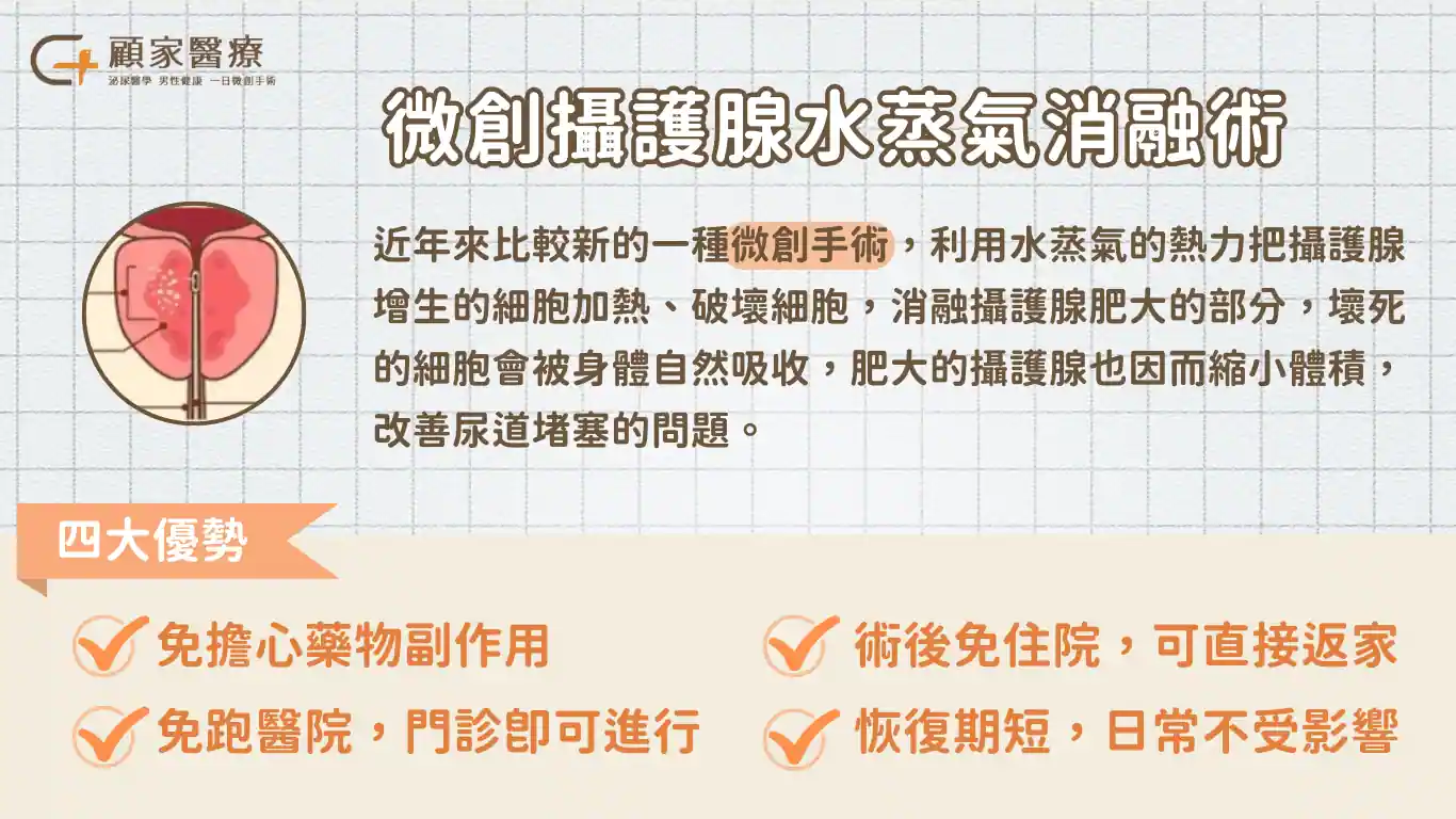 攝護腺肥大手術介紹－水蒸氣消融術
