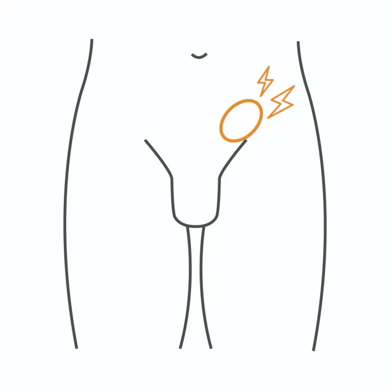 疝氣