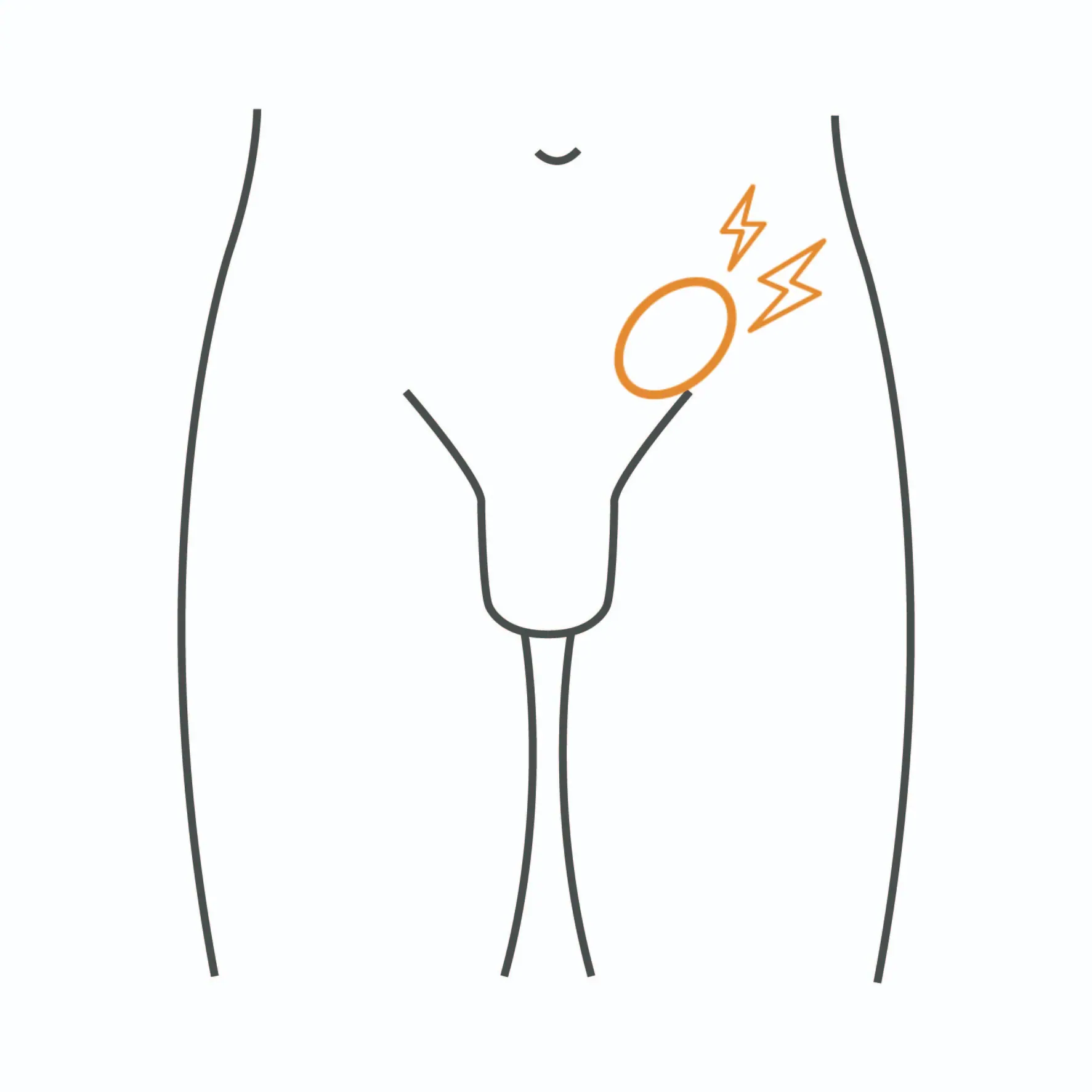 疝氣