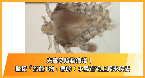 夫妻染陰蝨癢爆