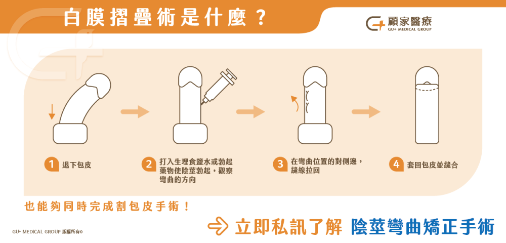 白膜摺疊術是什麼?