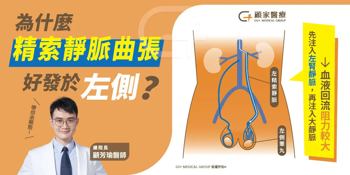為什麼精索靜脈曲張好發於左側