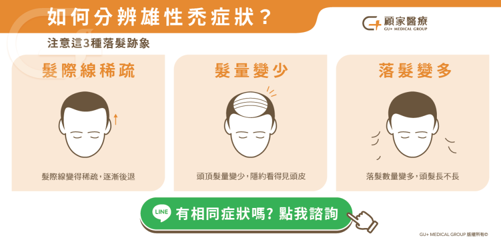 雄性禿症狀