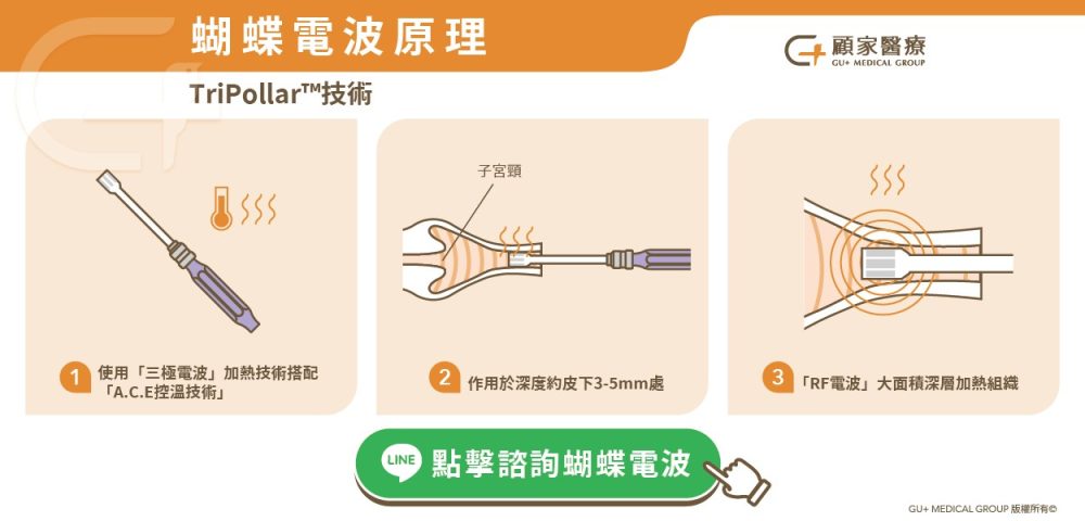 蝴蝶電波原理