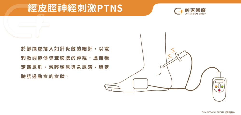 ptns作用示意