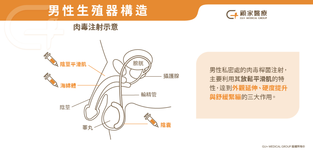 陰莖陰囊(GG)肉毒注射示意