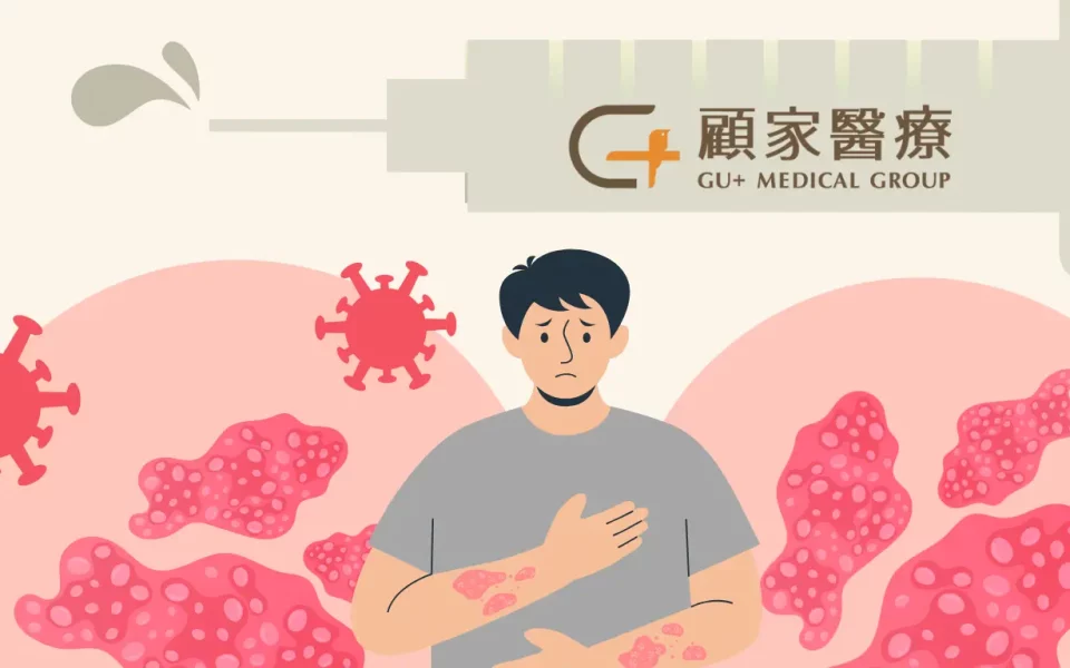 帶狀疱疹疫苗banner一個男人為了帶狀皰疹而苦惱