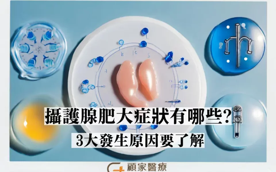 顧家醫療 攝護腺肥大症狀有哪些3大發生原因